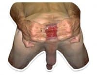 «analpack» sticker set
